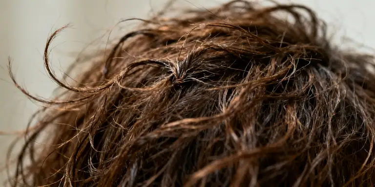 frizzy hair