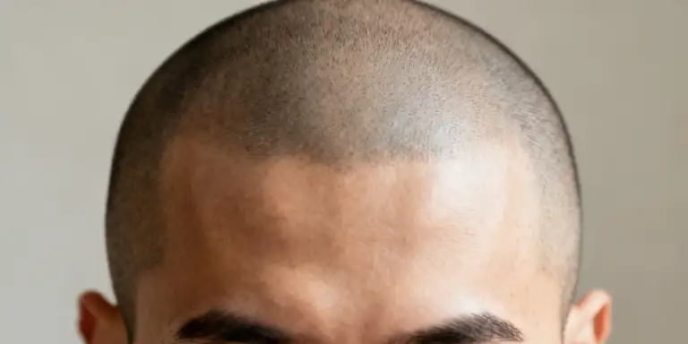 бритая голова